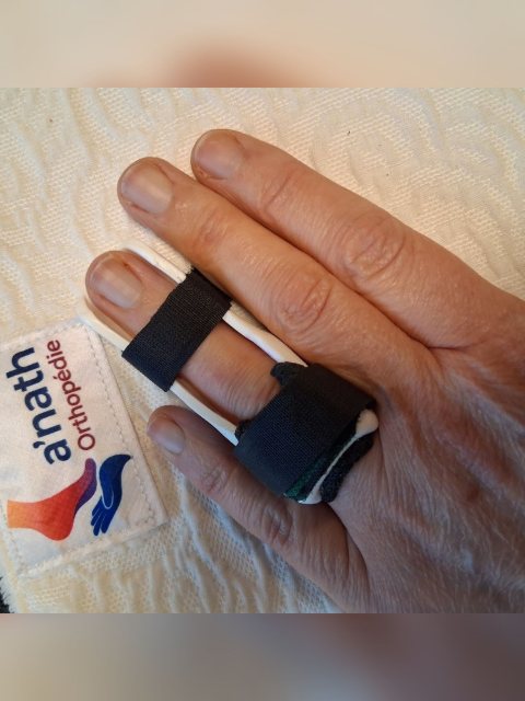 Petite orthèse thermoformée noire sur l'index, qui maintient une articulation du doigt.